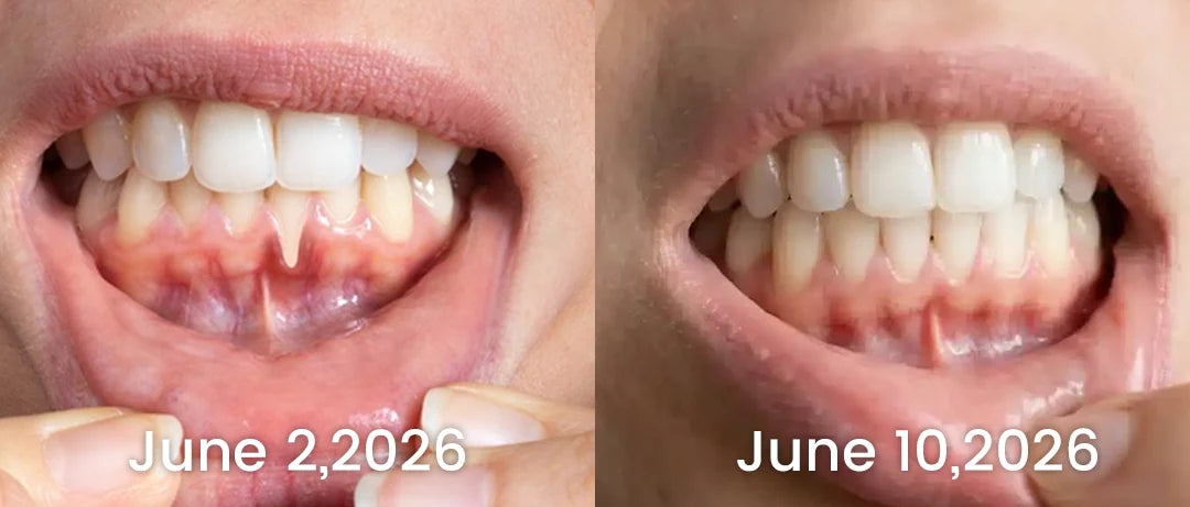LOVILDS Gingivitis Treatment Toothpaste