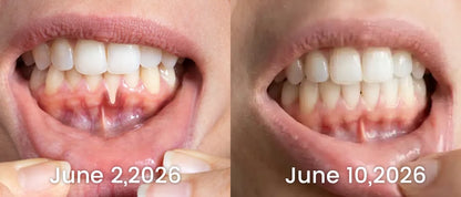 LOVILDS Gingivitis Treatment Toothpaste